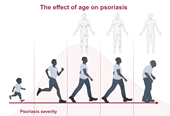 Ageing and Psoriasis